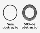 Grau I – Desde normal até 50% de obstrução.
